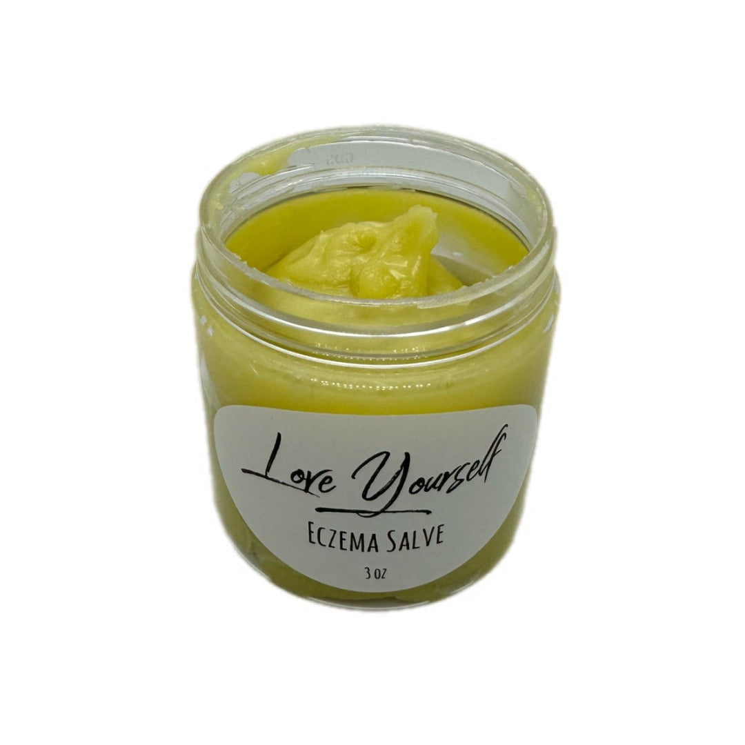 Eczema Salve